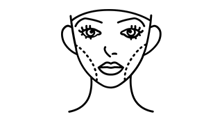 BICHECTOMIA