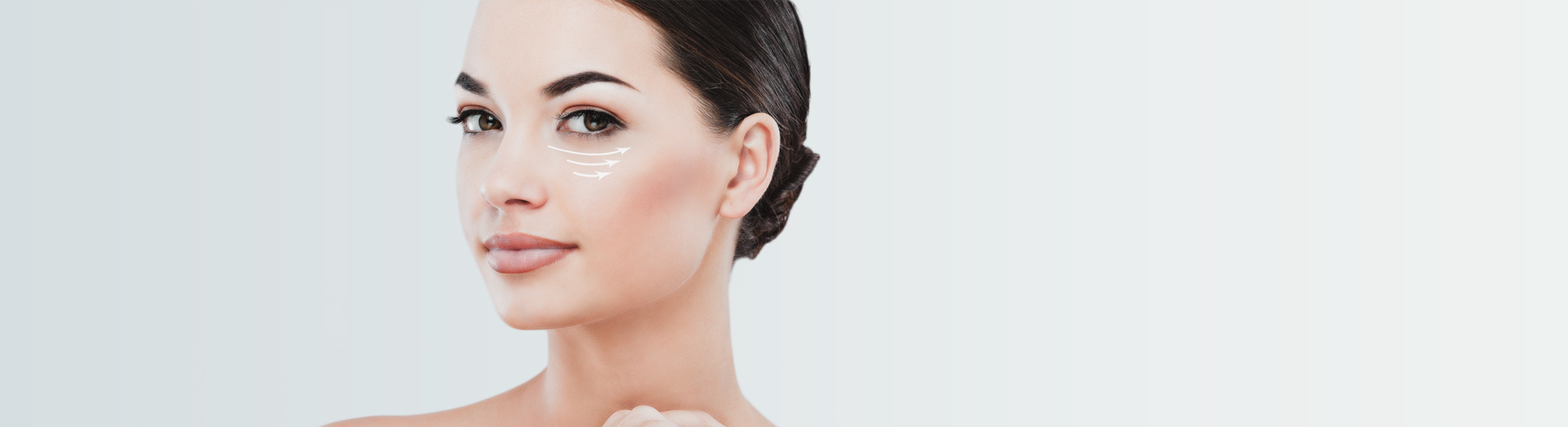 BLEFAROPLASTIA