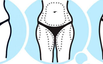 Cirugía Plástica  – cuidados antes y después