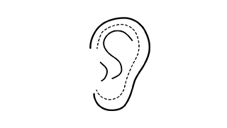 OTOPLASTIA