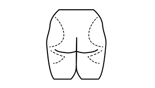 gluteoplastia GLUTEOPLASITA
