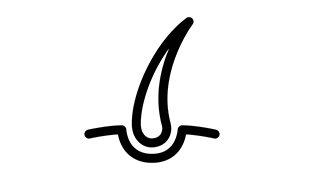 implante de cabello